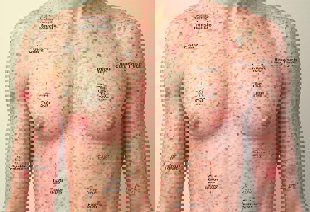 Tracing Unusual Skin Spot Patterns