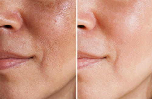 Is It Possible to Reverse Aging?